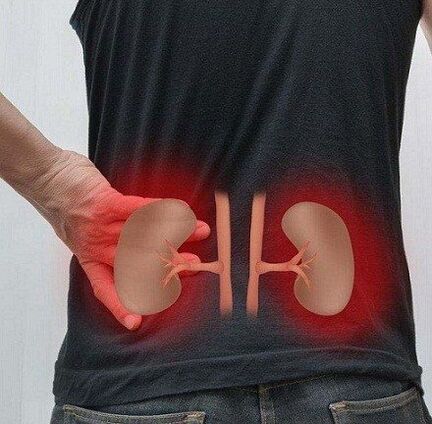 Pain low can occur with pyelonephritis