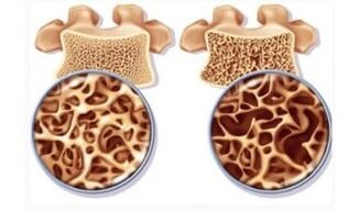 Danger from the uterion of cervical for women