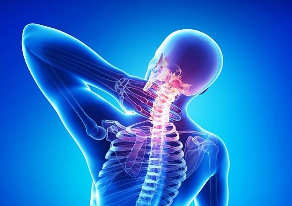 Bol in the Grlić spine with osteochondrose